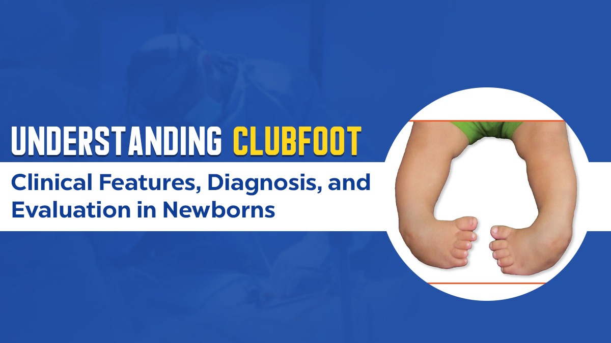 Understanding Clubfoot: Clinical Features, Diagnosis, and Evaluation in Newborns