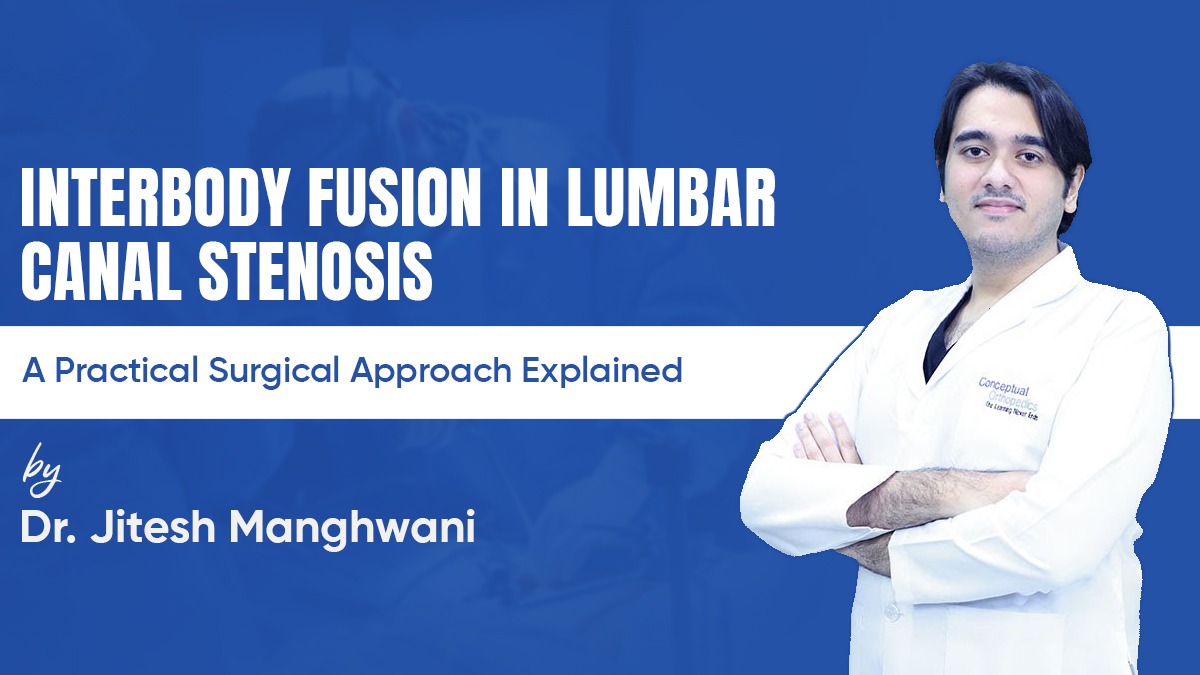 Interbody Fusion in Lumbar Canal Stenosis- A Practical Surgical Approach Explained by Dr. Jitesh Manghwani 