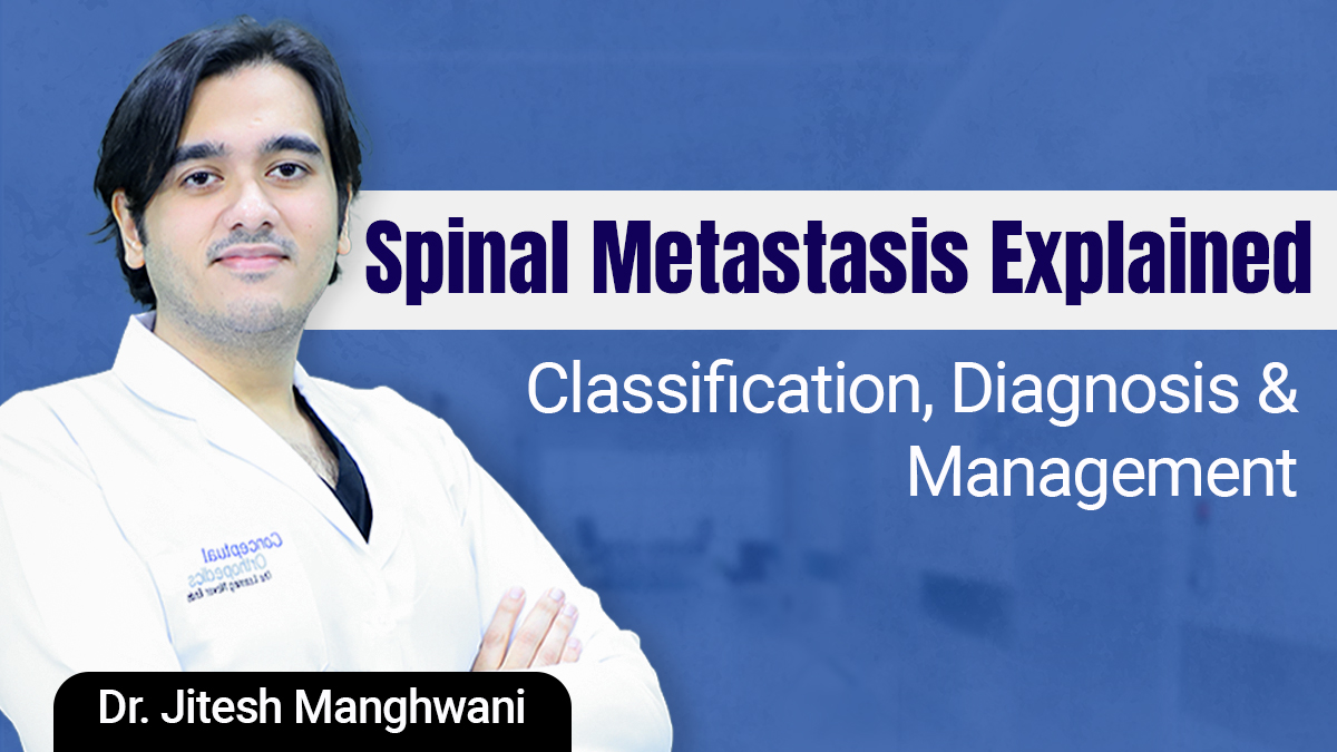 Spinal Metastasis Explained: Classification, Diagnosis & Management By Dr. Jitesh Manghwani 