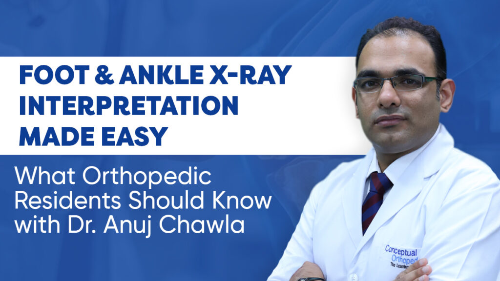 Foot & Ankle X-Ray Interpretation